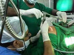 Micro-Laryneal-Surgery