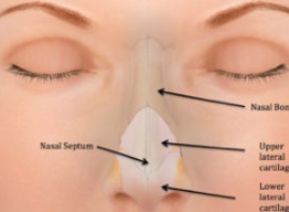 Nasal-Septal-Thematom